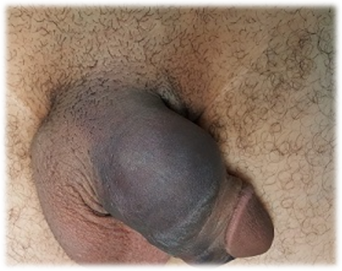PHO_013