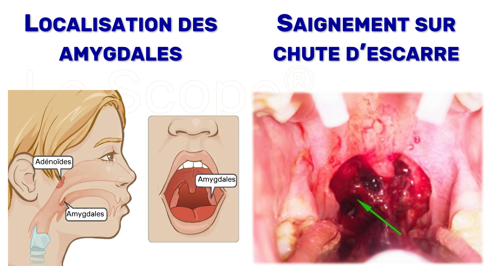 Illustration médicale de l'article