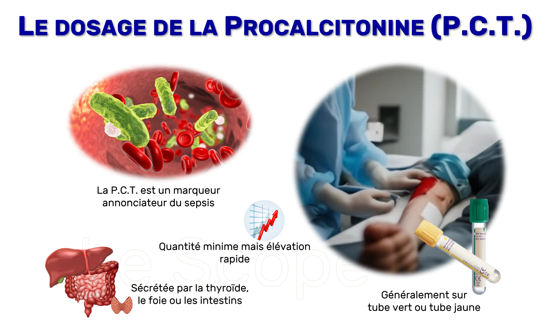 Illustration médicale de l'article