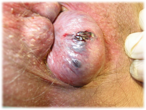 PHO_053