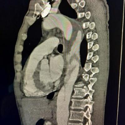 Vue profil dissection