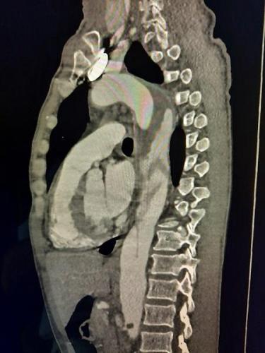 Vue profil dissection