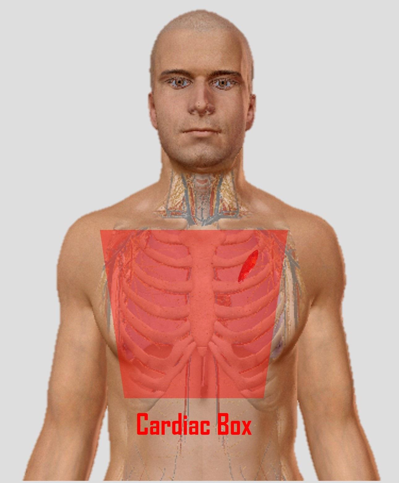 Cardiac box 1