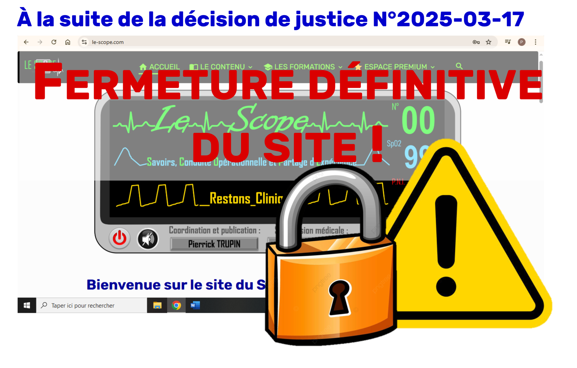 Le Scope : Fermeture définitive du site !