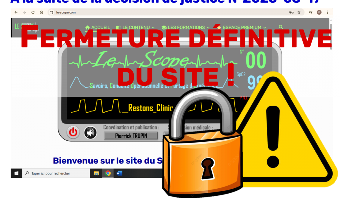 Le Scope : Fermeture définitive du site !