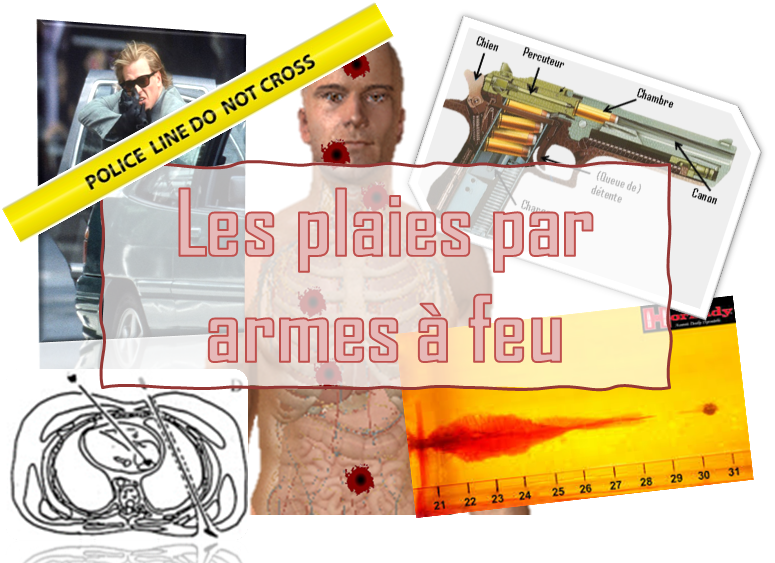 Les plaies par armes a feu